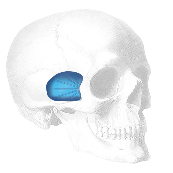 Temporal Shell Implantat, links