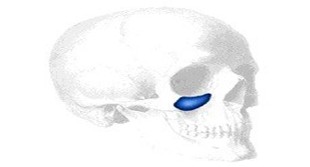 Flowers Tear Trough Implantat, Medium (2 Stk)