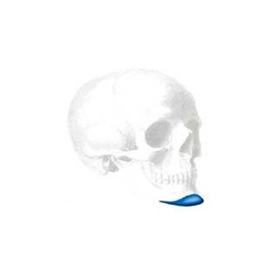 Conform Extended Anatomical Kinn Implantat,X-Large