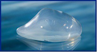 Terino Malar Shell Implantat, Large 0,5 cm (2 Stk.