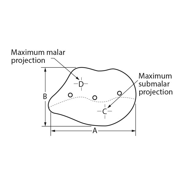 Combined Submalar Shell Implantat, Small (2 Stk.)