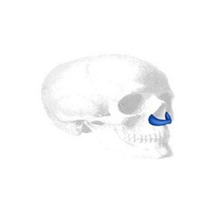 Peri-Pyriform Implantat, Large