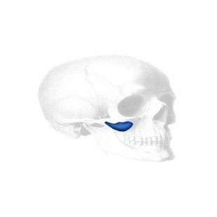 Binder Submalar Facial Implantat, Large, (2 Stk.)