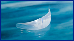 Anatomical Kinn Implant, Small